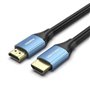 Cabo HDMI 2.0 4K Vention ALHSL, HDMI Macho - HDMI Macho, 10m, Azul